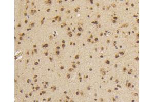 Paraformaldehyde-fixed, paraffin embedded mouse brain, Antigen retrieval by boiling in sodium citrate buffer (pH6) for 15min, Block endogenous peroxidase by 3% hydrogen peroxide for 30 minutes, Blocking buffer at 37°C for 20min, Antibody incubation with Smad5(S463/465) (1B8) Monoclonal Antibody  at 1:50 overnight at 4°C, followed by a conjugated secondary and DAB staining. (SMAD5 抗体  (pSer463, pSer465))
