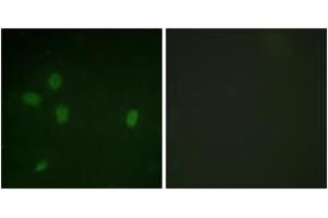 Immunofluorescence (IF) image for anti-Tumor Protein P53 Binding Protein 1 (TP53BP1) (AA 10-59), (pSer25) antibody (ABIN1531569)