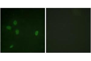 Immunofluorescence analysis of NIH-3T3 cells, using 53BP1 (Phospho-Ser25) Antibody. (TP53BP1 抗体  (pSer25))