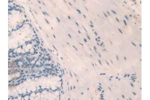 Detection of NPM1 in Mouse Small intestine Tissue using Polyclonal Antibody to Nucleophosmin 1 (NPM1)