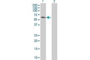 Western Blot analysis of ANGPTL3 expression in transfected 293T cell line ( H00027329-T01 ) by ANGPTL3 MaxPab polyclonal antibody. (ANGPTL3 抗体  (AA 1-460))