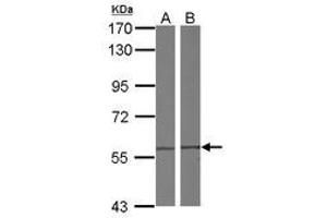 Image no. 1 for anti-Chaperonin Containing TCP1, Subunit 4 (Delta) (CCT4) (AA 79-378) antibody (ABIN1497138) (CCT4 抗体  (AA 79-378))