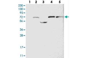 Western blot analysis of Lane 1: RT-4, Lane 2: U-251 MG, Lane 3: Human Plasma, Lane 4: Liver, Lane 5: Tonsil with GUCY1B3 polyclonal antibody  at 1:250-1:500 dilution. (GUCY1B3 抗体)