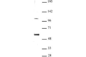 ELP3 antibody (pAb) tested by Western blot. (ELP3/KAT9 抗体  (N-Term))