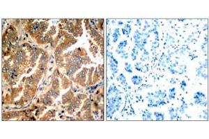 Image no. 1 for anti-Adducin 1 (Alpha) (ADD1) (Ser726) antibody (ABIN197406) (alpha Adducin 抗体  (Ser726))