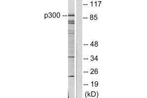 Western blot analysis of extracts from COLO205 cells, using P300/CBP antibody. (EP3/CREBBP 抗体)
