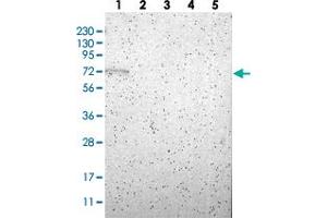 Western blot analysis of Lane 1: RT-4, Lane 2: U-251 MG, Lane 3: Human Plasma, Lane 4: Liver, Lane 5: Tonsil with RBM47 polyclonal antibody  at 1:250-1:500 dilution. (RBM47 抗体)