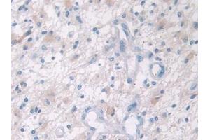 Immunohistochemistry (IHC) image for anti-Profilin 2 (PFN2) (AA 5-140) antibody (ABIN7437743)