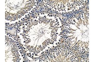 ABIN6259328 and ABIN6275301 at 1/100 staining rat testis tissue by IHC-P. (NBPF7 抗体  (C-Term))