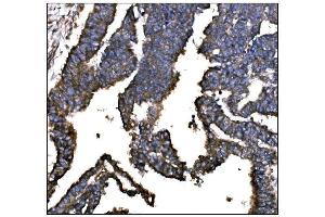IHC analysis of IGF2R using anti-IGF2R antibody (ABIN7601705).