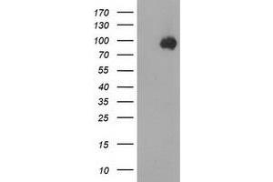 HEK293T cells were transfected with the pCMV6-ENTRY control (Left lane) or pCMV6-ENTRY CTNNB1 (Right lane) cDNA for 48 hrs and lysed. (CTNNB1 抗体)