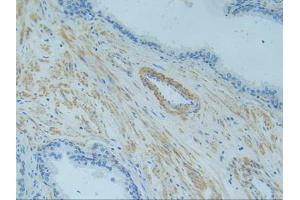 IHC-P analysis of Human Prostate Gland Tissue, with DAB staining. (TNFRSF1A 抗体  (AA 60-236))