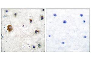 Immunohistochemistry (IHC) image for anti-Gap Junction Protein, alpha 1, 43kDa (GJA1) (C-Term) antibody (ABIN1848480) (Connexin 43/GJA1 抗体  (C-Term))