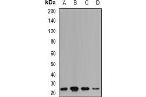 Western blot analysis of mPR expression in HepG2 (A), SW480 (B), mouse liver (C), mouse brain (D) whole cell lysates. (mPR 抗体)