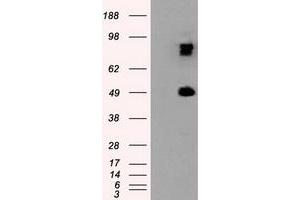 Western Blotting (WB) image for anti-Proteasome (Prosome, Macropain) 26S Subunit, ATPase, 3 (PSMC3) antibody (ABIN1501328) (PSMC3 抗体)