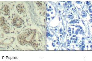 Image no. 1 for anti-Mdm2, p53 E3 Ubiquitin Protein Ligase Homolog (Mouse) (MDM2) (pSer166) antibody (ABIN401610) (MDM2 抗体  (pSer166))