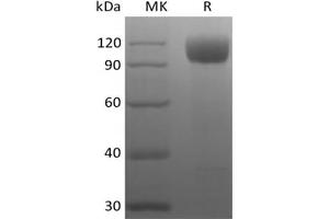 Western Blotting (WB) image for Angiotensin I Converting Enzyme 2 (ACE2) (Active) protein (His tag) (ABIN7321043)