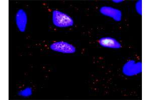 Proximity Ligation Analysis of protein-protein interactions between OSMR and ERBB2. (Oncostatin M Receptor 抗体  (AA 1-342))