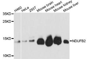 Western blot analysis of extracts of various cell lines, using NDUFB2 antibody (ABIN5972152) at 1:3000 dilution. (NDUFB2 抗体)