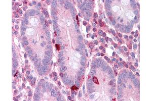 Immunohistochemistry (IHC) image for anti-Eukaryotic Translation Elongation Factor 2 (EEF2) (N-Term) antibody (ABIN2787690) (EEF2 抗体  (N-Term))