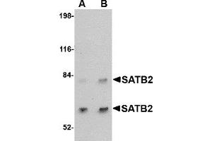 Western Blotting (WB) image for anti-SATB Homeobox 2 (SATB2) (C-Term) antibody (ABIN1030643) (SATB2 抗体  (C-Term))