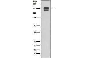 Western blot analysis of using Integrin beta1 expression in 293T cell lysate.