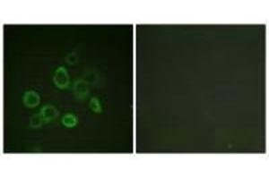 Immunofluorescence analysis of LOVO cells, using Bax (Ab-167) antibody. (BAX 抗体  (Thr167))