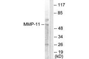 Western blot analysis of extracts from A549 cells, using MMP-11 Antibody. (MMP11 抗体  (AA 61-110))