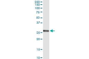 Immunoprecipitation of PSMA7 transfected lysate using anti-PSMA7 MaxPab rabbit polyclonal antibody and Protein A Magnetic Bead , and immunoblotted with PSMA7 MaxPab mouse polyclonal antibody (B01) . (PSMA7 抗体  (AA 1-248))
