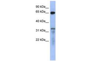 Image no. 1 for anti-RAP1 GTPase Activating Protein (RAP1GAP) (AA 503-552) antibody (ABIN6744090) (RAP1GAP 抗体  (AA 503-552))