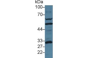 Detection of GCLM in Human MCF7 cell lysate using Polyclonal Antibody to Glutamate Cysteine Ligase, Modifier Subunit (GCLM) (GCLM 抗体  (AA 40-251))