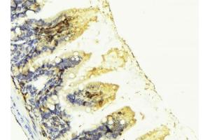 Immunohistochemistry (IHC) image for anti-Placenta Growth Factor (PGF) (Internal Region) antibody (ABIN6264164)