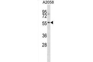 Western Blotting (WB) image for anti-BTB (POZ) Domain Containing 14A (BTBD14A) antibody (ABIN2998943) (BTBD14A 抗体)