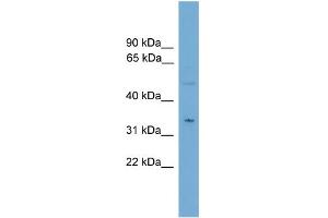 WB Suggested Anti-MGLL  Antibody Titration: 0. (MGLL 抗体  (N-Term))