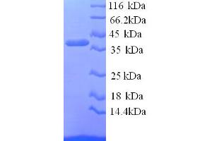 SDS-PAGE (SDS) image for Pregnancy Zone Protein (PZP) (AA 472-821), (partial) protein (His tag) (ABIN5713778)