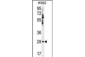 HSD11B1L Antibody (C-term) (ABIN655425 and ABIN2844963) western blot analysis in K562 cell line lysates (35 μg/lane). (HSD11B1L 抗体  (C-Term))