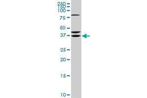 RDHE2 monoclonal antibody (M01), clone 3G8. (SDR16C5 抗体  (AA 26-309))