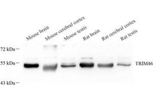 Western blot analysis of TRIM46 (ABIN7076020) at dilution of 1: 2000 (TRIM46 抗体)