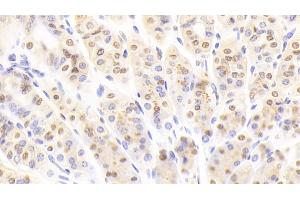 Immunohistochemistry (IHC) image for anti-Nucleoporin 88kDa (NUP88) (AA 57-296) antibody (ABIN7441823)