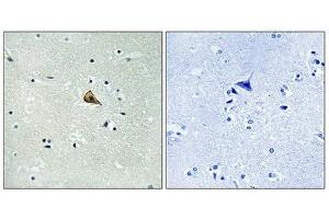 Immunohistochemistry (IHC) image for anti-Neurotrophic Tyrosine Kinase, Receptor, Type 1 (NTRK1) (pTyr701) antibody (ABIN7139049)