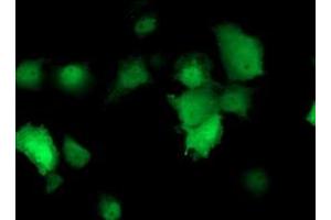 Anti-TMOD1 mouse monoclonal antibody (ABIN2454777) immunofluorescent staining of COS7 cells transiently transfected by pCMV6-ENTRY TMOD1 (RC201134). (Tropomodulin 1 抗体)