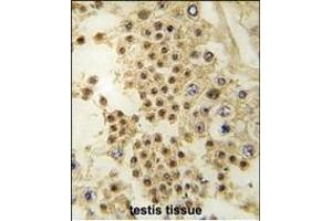 Formalin-fixed and paraffin-embedded human testis tissue reacted with LIN28A antibody (C-term) (ABIN6243718 and ABIN6578921) , which was peroxidase-conjugated to the secondary antibody, followed by DAB staining. (LIN28A 抗体  (C-Term))