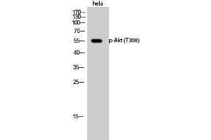 Western Blotting (WB) image for anti-V-Akt Murine Thymoma Viral Oncogene Homolog 1 (AKT1) (pThr308) antibody (ABIN3179385) (AKT1 抗体  (pThr308))
