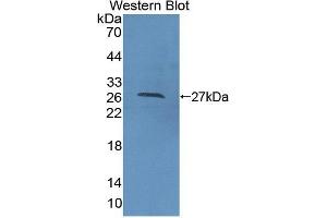 Western blot analysis of the recombinant protein. (CDC42 抗体  (AA 1-188))