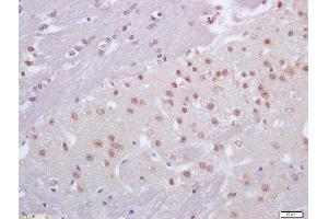 Formalin-fixed and paraffin embedded mouse brain labeled with Anti-CRX1 Polyclonal Antibody, Unconjugated  at 1:200 followed by conjugation to the secondary antibody and DAB staining (CRX 抗体  (AA 51-150))