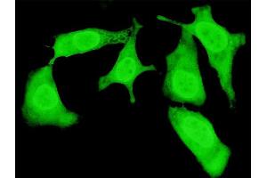 Immunofluorescence of monoclonal antibody to TRIP10 on HeLa cell. (TRIP10 抗体  (AA 231-329))