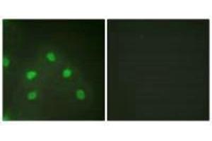 Immunofluorescence analysis of HeLa cells, using hnRNP L antibody. (HNRNPL 抗体  (N-Term))