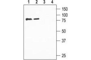 Western Blotting (WB) image for anti-Sodium Channel, Nonvoltage-Gated 1, beta (SCNN1B) (AA 498-513), (Extracellular) antibody (ABIN7043635)