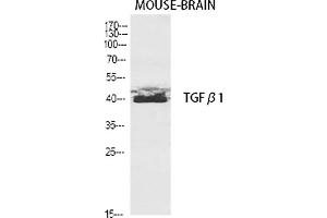 Western Blot analysis of various cells using TGFβ1 Polyclonal Antibody diluted at 1:2000. (TGFB1 抗体  (AA 310-390))