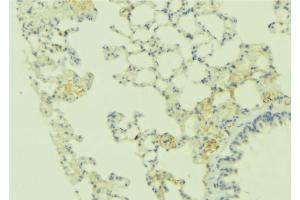 ABIN6269242 at 1/100 staining Human lung tissue by IHC-P. (CASR 抗体  (C-Term))
